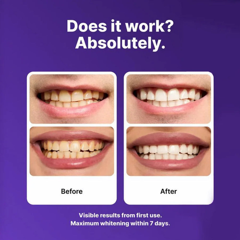 Before and after comparison of teeth whitening with text on a purple background